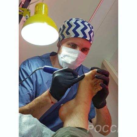 Медицинский педикюр